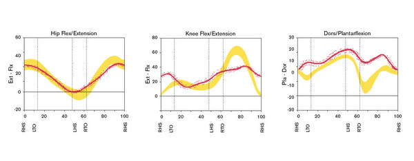 gait analysis testing