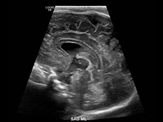 Ultrasound image